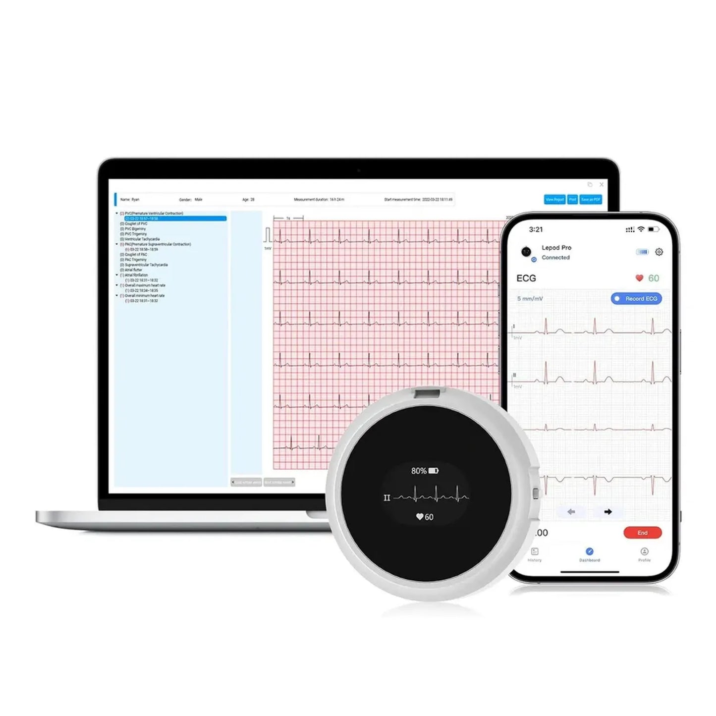 Moniteur ECG LepodPro 12 Dérivations avec Écran OLED, Enregistrement 24h, Analyse IA